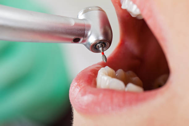 Best Urgent Care for Lost Fillings or Crowns in Mount Ivy, NY